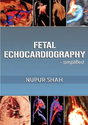 Echocardiographie fœtale - Simplifiée - Fetal Echocardiography - Simplified