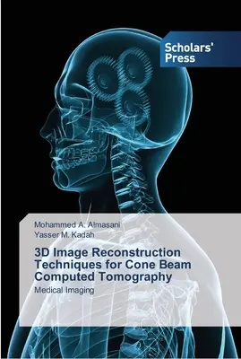 Techniques de reconstruction d'images en 3D pour la tomographie assistée par ordinateur à faisceau conique - 3D Image Reconstruction Techniques for Cone Beam Computed Tomography