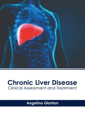 Maladie chronique du foie : Évaluation et traitement cliniques - Chronic Liver Disease: Clinical Assessment and Treatment