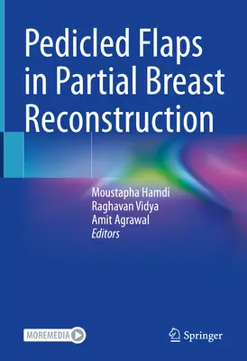 Les lambeaux pédiculés dans la reconstruction partielle du sein - Pedicled Flaps in Partial Breast Reconstruction
