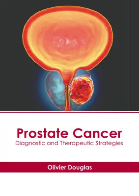 Le cancer de la prostate : Stratégies diagnostiques et thérapeutiques - Prostate Cancer: Diagnostic and Therapeutic Strategies