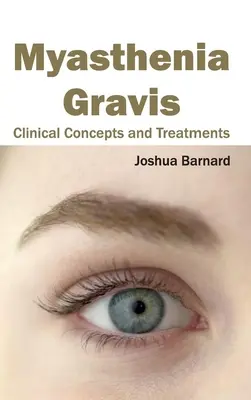 Myasthenia Gravis : Concepts cliniques et traitements - Myasthenia Gravis: Clinical Concepts and Treatments