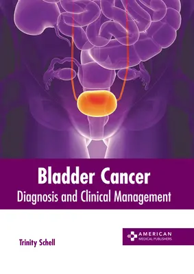 Cancer de la vessie : Diagnostic et gestion clinique - Bladder Cancer: Diagnosis and Clinical Management