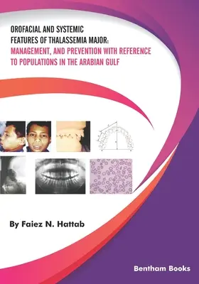 Caractéristiques orofaciales et systémiques de la thalassémie majeure : Gestion et prévention en ce qui concerne les populations du golfe Arabo-Persique - Orofacial and Systemic Features of Thalassemia Major: Management, and Prevention with Reference to Populations in the Arabian Gulf