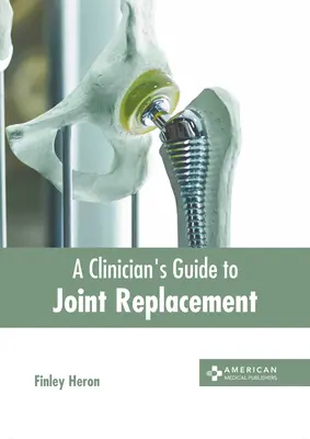Guide du clinicien pour le remplacement des articulations - A Clinician's Guide to Joint Replacement