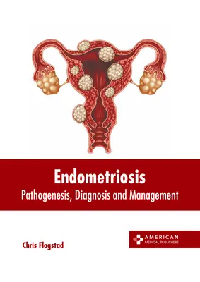 Endométriose : Pathogenèse, diagnostic et prise en charge - Endometriosis: Pathogenesis, Diagnosis and Management
