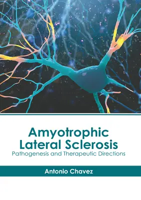 La sclérose latérale amyotrophique : Pathogenèse et orientations thérapeutiques - Amyotrophic Lateral Sclerosis: Pathogenesis and Therapeutic Directions