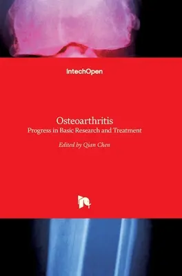 L'arthrose : Progrès dans la recherche fondamentale et le traitement - Osteoarthritis: Progress in Basic Research and Treatment