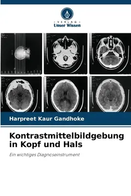 Kontrastmittelbildgebung in Kopf und Hals (en anglais) - Kontrastmittelbildgebung in Kopf und Hals