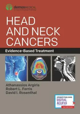 Cancers de la tête et du cou : Traitement fondé sur des données probantes - Head and Neck Cancers: Evidence-Based Treatment