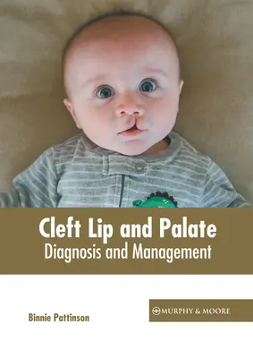 Fentes labiales et palatines : Diagnostic et prise en charge - Cleft Lip and Palate: Diagnosis and Management