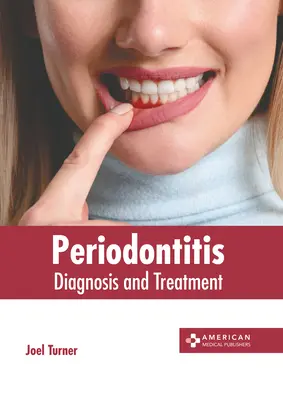 Parodontite : Diagnostic et traitement - Periodontitis: Diagnosis and Treatment
