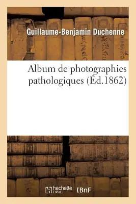 Album de Photographies Pathologiques, Complémentaire Du Livre Intitul de l'lectrisation Localise - Album de Photographies Pathologiques, Complmentaire Du Livre Intitul de l'lectrisation Localise