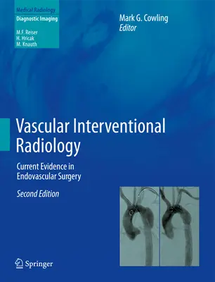 Radiologie interventionnelle vasculaire : Les données actuelles de la chirurgie endovasculaire - Vascular Interventional Radiology: Current Evidence in Endovascular Surgery