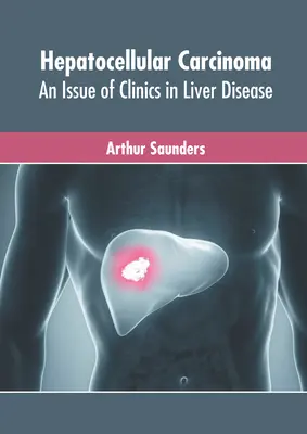 Carcinome hépatocellulaire : un numéro des Cliniques des maladies du foie - Hepatocellular Carcinoma: An Issue of Clinics in Liver Disease