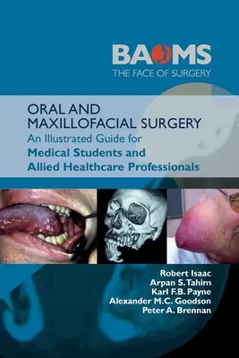 Chirurgie orale et maxillo-faciale : Un guide illustré pour les étudiants en médecine et les professionnels de la santé: : Un guide illustré pour les étudiants en médecine et les professionnels paramédicaux - Oral and Maxillofacial Surgery: An Illustrated Guide for Medical Students and Allied Healthcare Professionals:: An Illustrated Guide for Medical Stude