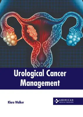 Gestion des cancers urologiques - Urological Cancer Management