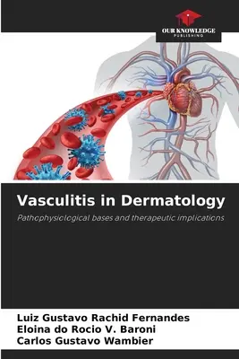 Vascularite en dermatologie - Vasculitis in Dermatology