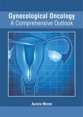 Oncologie gynécologique : Un aperçu complet - Gynecological Oncology: A Comprehensive Outlook