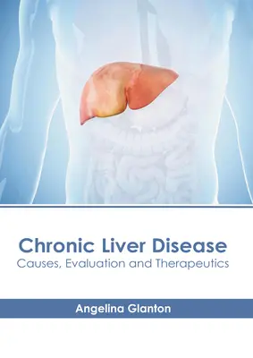 Maladie chronique du foie : Causes, évaluation et thérapeutique - Chronic Liver Disease: Causes, Evaluation and Therapeutics