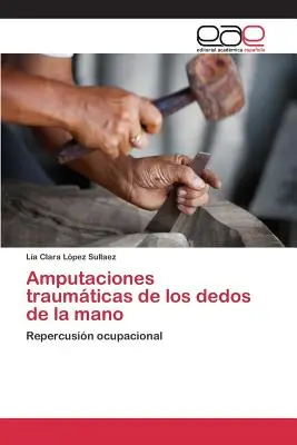 Amputations traumatiques des doigts de la main - Amputaciones traumticas de los dedos de la mano
