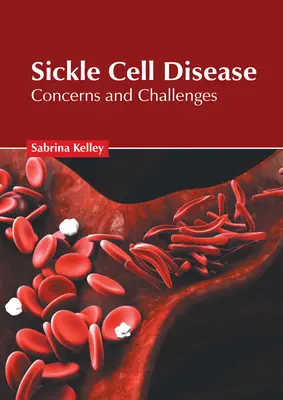 La drépanocytose : Inquiétudes et défis - Sickle Cell Disease: Concerns and Challenges