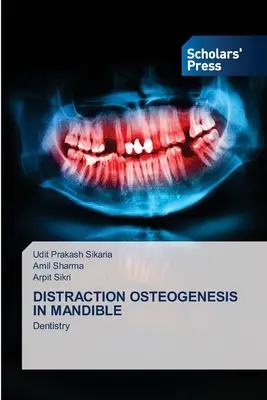 Ostéogenèse de distraction dans la mandibule - Distraction Osteogenesis in Mandible