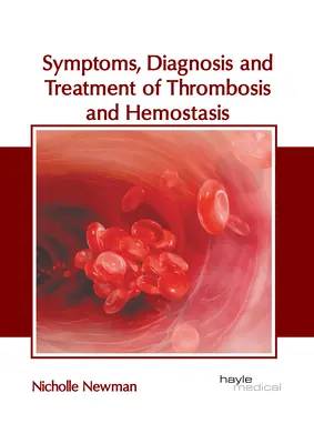 Symptômes, diagnostic et traitement de la thrombose et de l'hémostase - Symptoms, Diagnosis and Treatment of Thrombosis and Hemostasis
