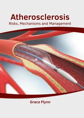 L'athérosclérose : Risques, mécanismes et prise en charge - Atherosclerosis: Risks, Mechanisms and Management