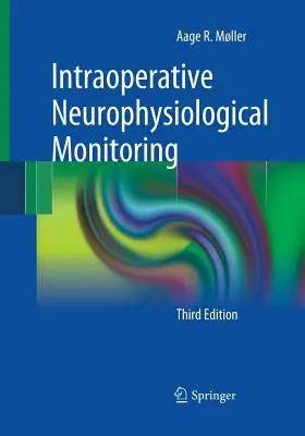 Surveillance neurophysiologique peropératoire - Intraoperative Neurophysiological Monitoring