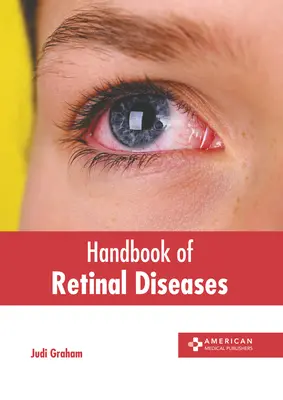 Manuel des maladies de la rétine - Handbook of Retinal Diseases