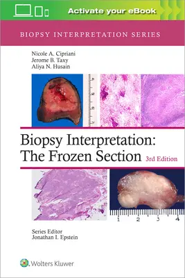 Interprétation des biopsies : La section congelée - Biopsy Interpretation: The Frozen Section
