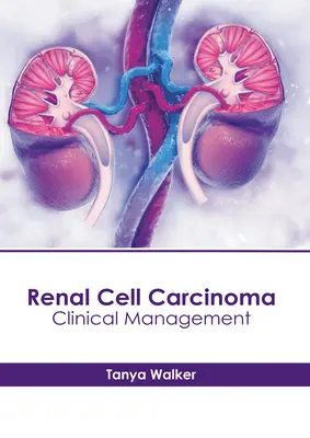 Carcinome à cellules rénales : gestion clinique - Renal Cell Carcinoma: Clinical Management