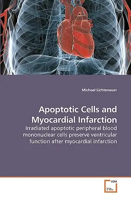 Cellules apoptotiques et infarctus du myocarde - Apoptotic Cells and Myocardial Infarction