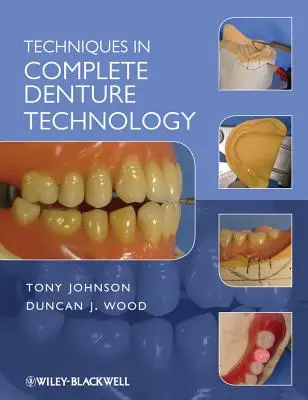 Techniques de prothèse complète - Techniques in Complete Denture