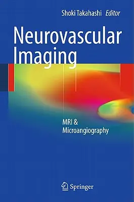 Imagerie neurovasculaire : IRM et microangiographie - Neurovascular Imaging: MRI & Microangiography