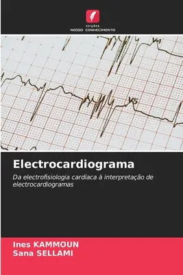 Électrocardiogramme - Electrocardiograma