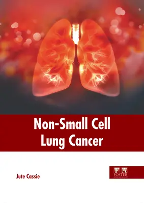 Cancer du poumon non à petites cellules - Non-Small Cell Lung Cancer