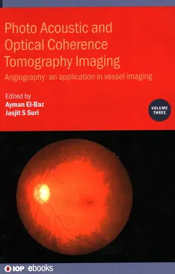 Imagerie par tomographie en cohérence optique et photo-acoustique : Angiographie : - Une application dans l'imagerie des vaisseaux - Photo Acoustic and Optical Coherence Tomography Imaging: Angiography: - An Application in Vessel Imaging