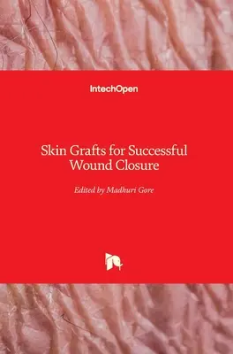 Greffes de peau pour une fermeture réussie des plaies - Skin Grafts for Successful Wound Closure