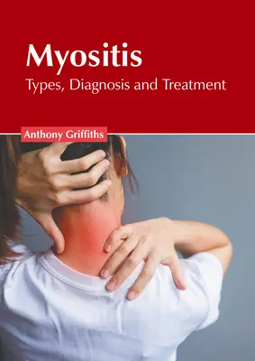 La myosite : Types, diagnostic et traitement - Myositis: Types, Diagnosis and Treatment