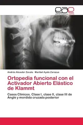 Ortopedia funcional con el Activador Abierto Elstico de Klammt