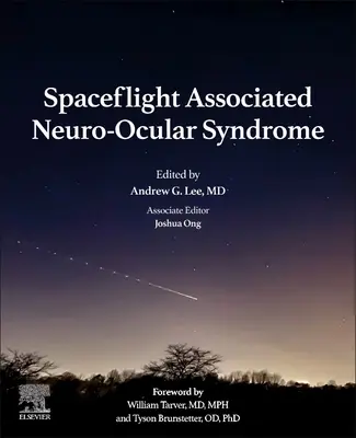 Syndrome neuro-oculaire associé aux vols spatiaux - Spaceflight Associated Neuro-Ocular Syndrome