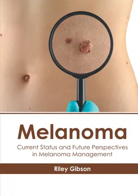 Mélanome : Situation actuelle et perspectives d'avenir dans la prise en charge du mélanome - Melanoma: Current Status and Future Perspectives in Melanoma Management