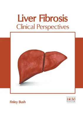 Fibrose du foie : Perspectives cliniques - Liver Fibrosis: Clinical Perspectives