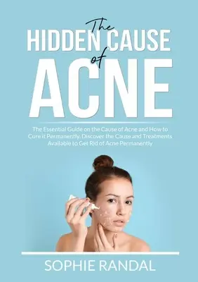 La cause cachée de l'acné : Le guide essentiel sur la cause de l'acné et comment la guérir de façon permanente, découvrez la cause et les traitements disponibles pour l'acné et le syndrome de l'intestin irritable. - The Hidden Cause of Acne: The Essential Guide on the Cause of Acne and How to Cure it Permanently, Discover the Cause and Treatments Available t
