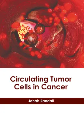 Les cellules tumorales circulantes dans le cancer - Circulating Tumor Cells in Cancer