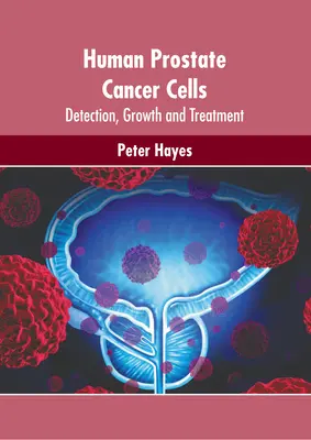 Cellules humaines du cancer de la prostate : Détection, croissance et traitement - Human Prostate Cancer Cells: Detection, Growth and Treatment