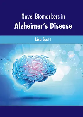 Nouveaux biomarqueurs de la maladie d'Alzheimer - Novel Biomarkers in Alzheimer's Disease