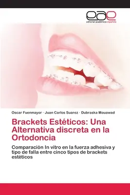 Brackets Estticos : Une alternative discrète à l'orthodontie - Brackets Estticos: Una Alternativa discreta en la Ortodoncia